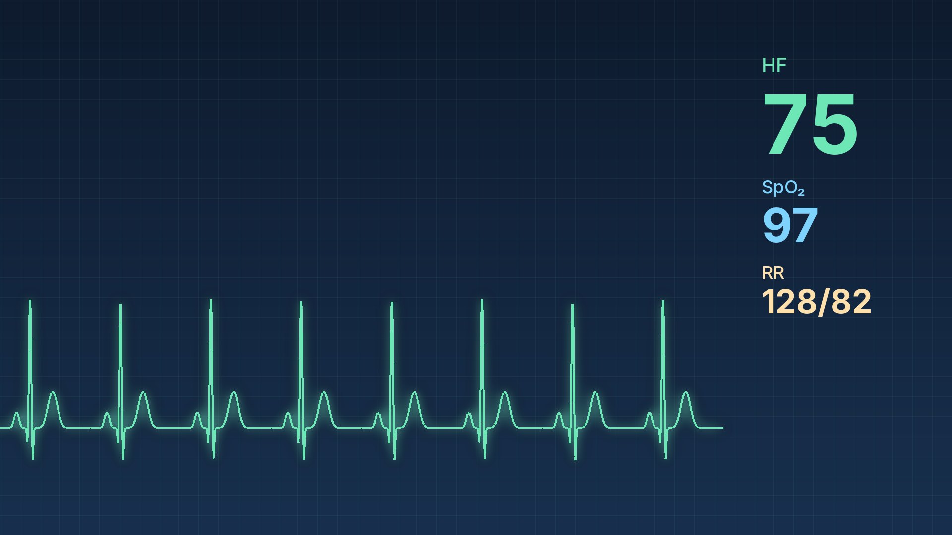 Monitorbild mit EKG